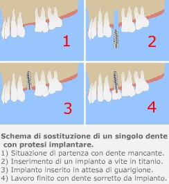 Schema Impianto